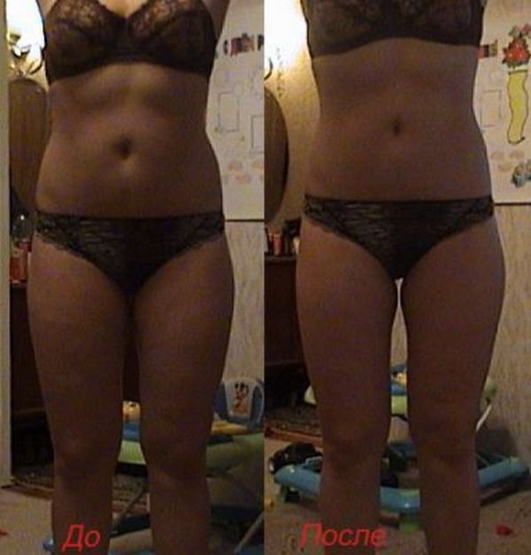 Медовое обертывание для похудения - до и после